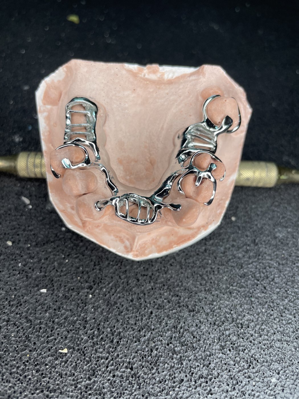 Estructura de PPR en cromo cobalto inferior asentada sobre modelo de yeso, vista oclusal